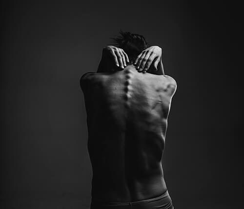 THE MINNESOTA STARVATION EXPERIMENT